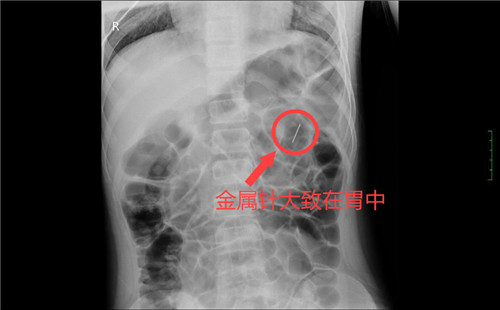 6b388412676945fea8c25f08d5abdef4.jpg