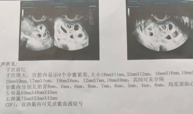 侯女士的检查单。来源:当事人社交媒体账号