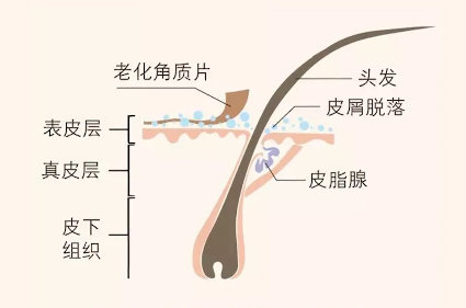 脱发.jpg