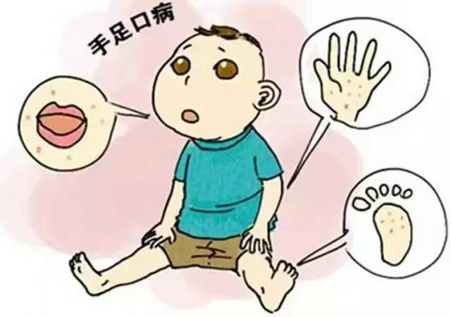 手足口病的症状.jpg