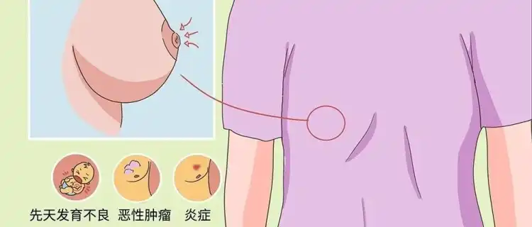 乳头出现这种情况，真的别大意...42岁女子确诊乳腺癌